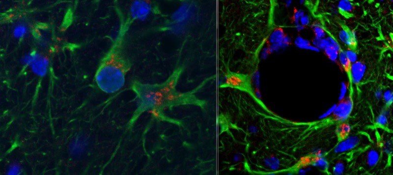 (Left) Astrocytes (green) express abundant chemokine CCL2 (red) after acute IL-1 insult and this chemokine is also expressed at the surface of brain blood vessels (right) to attract immune cells to the tissue.