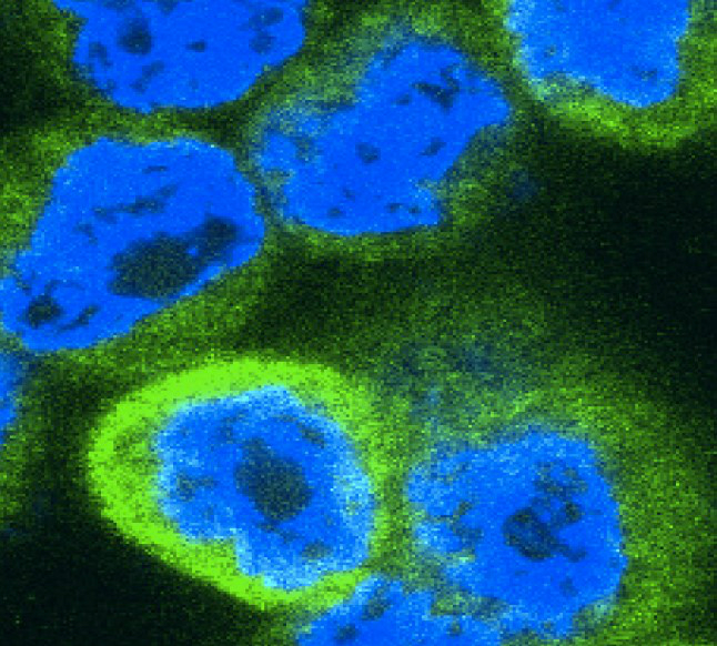 Cervical cancer cells expressing a wound-healing signal (green) in response to TRAIL stimulation. Image credit: Dr Conor Henry and Professor Seamus Martin, Trinity College Dublin.